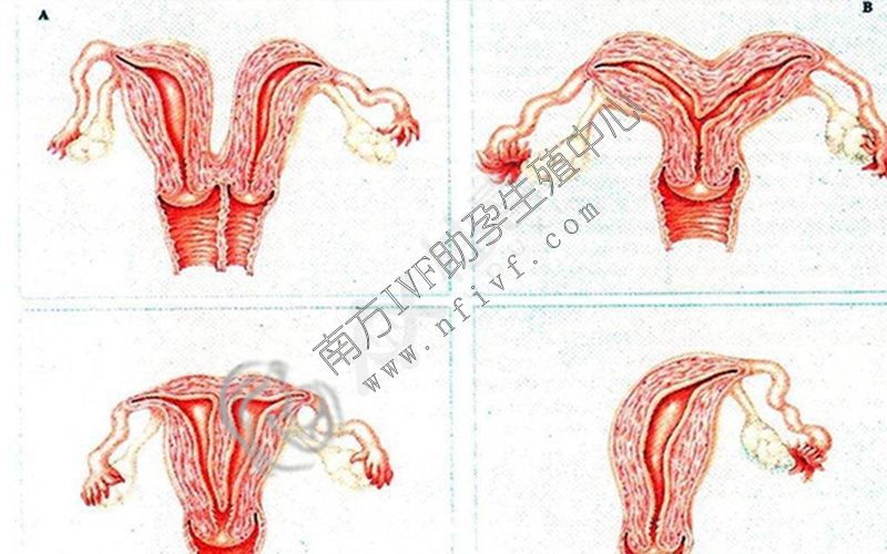 在10个案例中，有9个案例是导致子宫变长的原因。