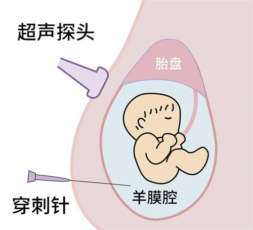 杭州省妇保试管婴儿需要多少费用-衢州哪家试管婴儿医院的成功率最高？附衢州市妇幼保健院试管婴儿费用明细。